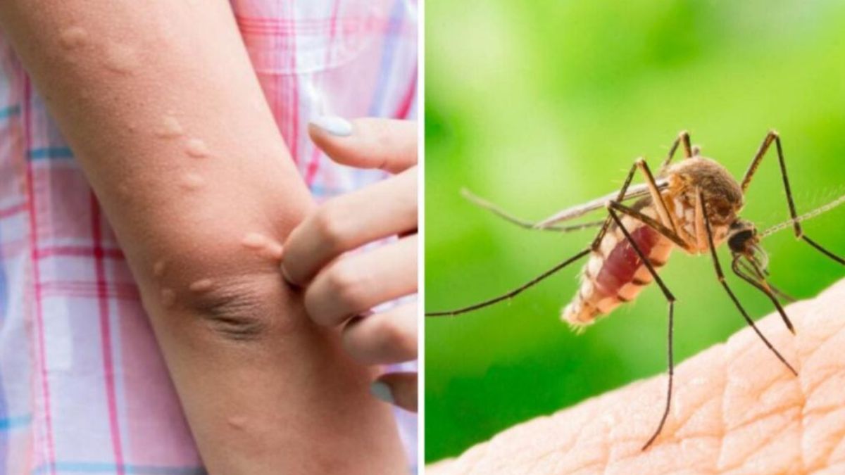 Par quoi les moustiques sont-ils attirés