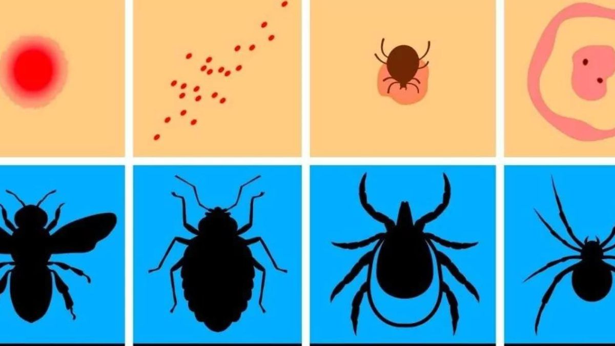 Ce n’est pas toujours une question de moustiques, mais plutôt de savoir quels insectes vous ont piqué