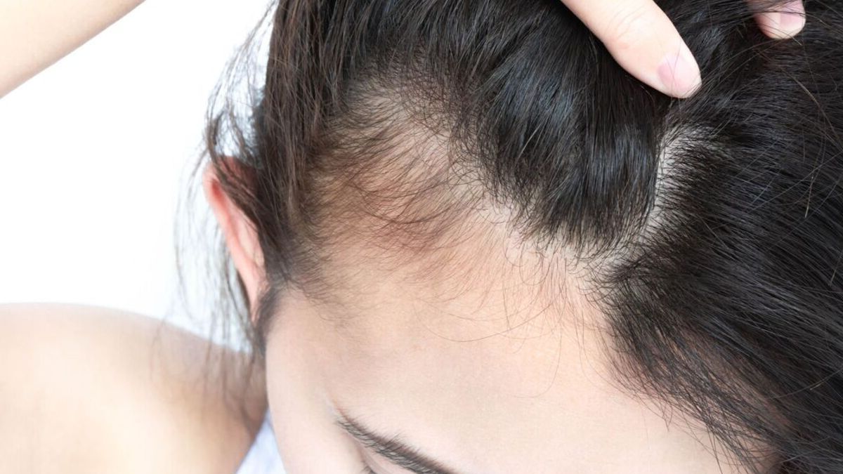 Comment prévenir la chute des cheveux : une solution naturelle maison pour lutter contre la chute des cheveux